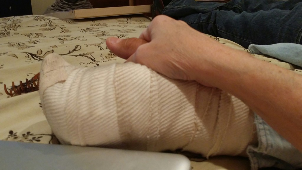 hand surgery